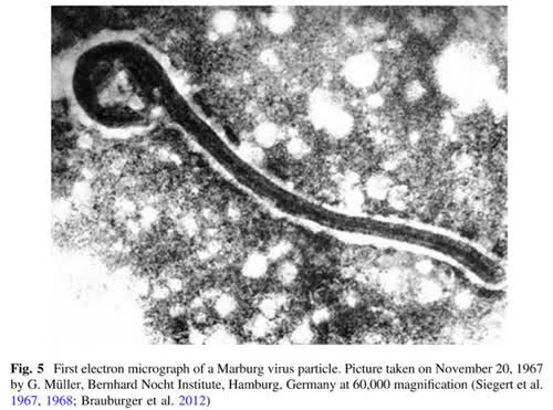First micrograph of the Marburg virus