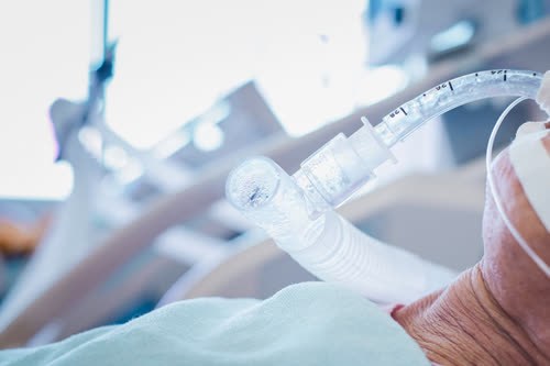 https://www.npr.org/sections/health-shots/2020/04/02/826105278/ventilators-are-no-panacea-for-critically-ill-covid-19-patients
