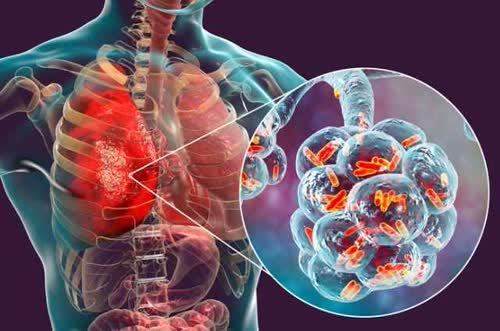 https://techstartups.com/2020/04/11/breaking-new-research-study-reveals-covid-19-attacks-hemoglobin-red-blood-cells-rendering-incapable-transporting-oxygen-fooled-covid-19-current-medical