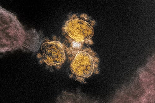 A colorized transmission electron microscope image of coronavirus.Credit...NIAID
